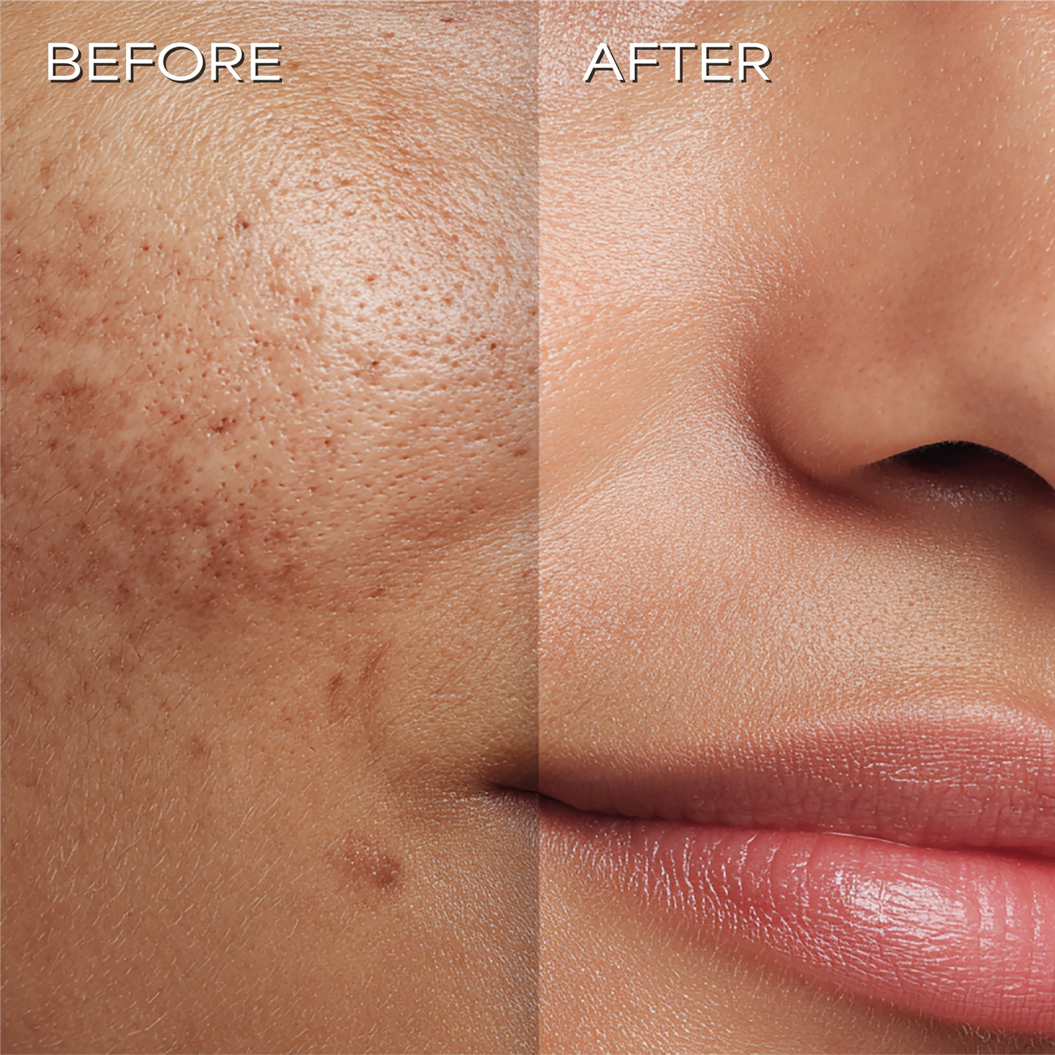 Ultra Radiance Moisturiser