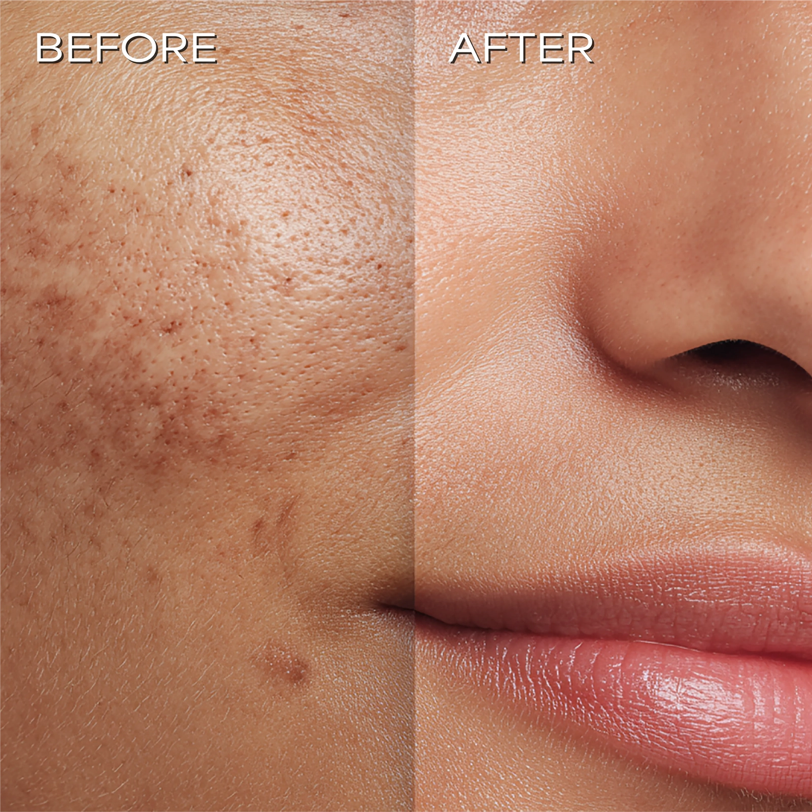 Ultra Radiance Moisturiser