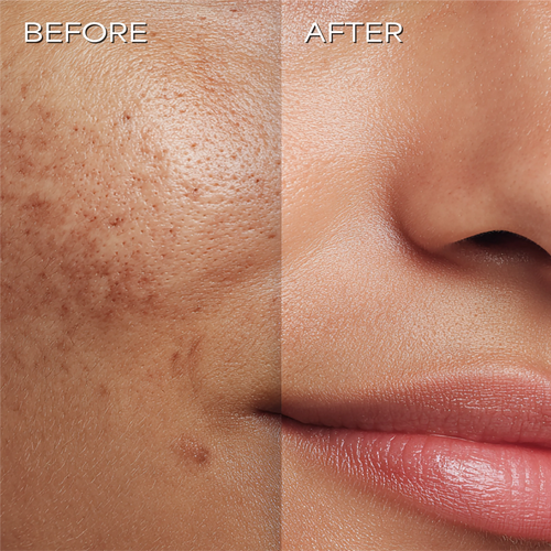 Ultra Radiance Moisturiser